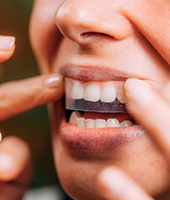 Woman using a teeth whitening strip