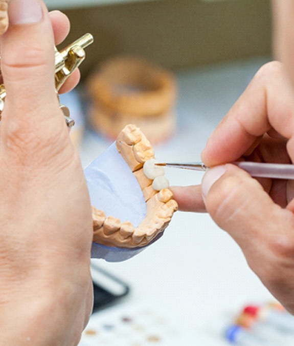 A dental lab technician creating a dental bridge based on the specifications provided by the dentist