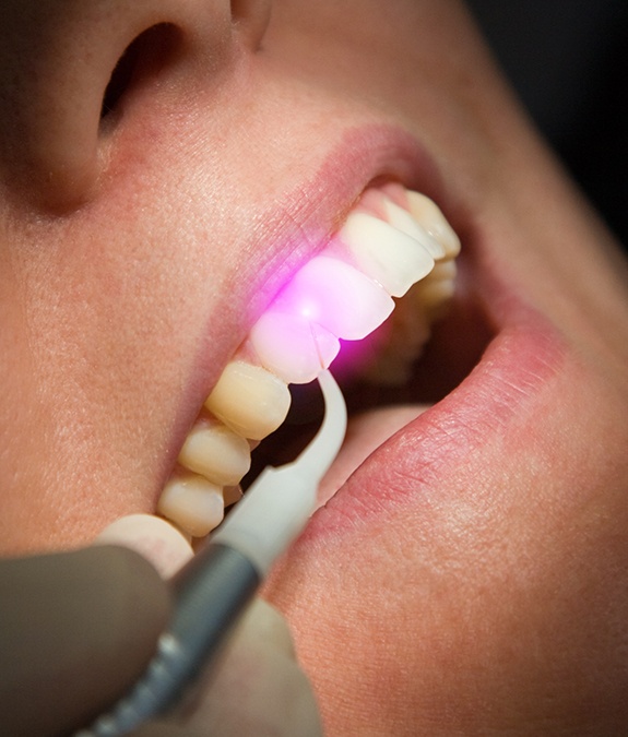 Woman with soft tissue laser behind tooth
