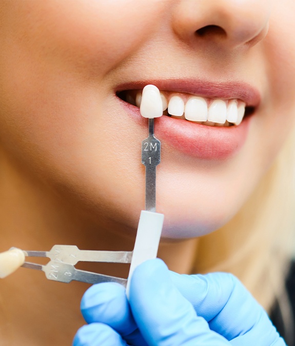 close up of woman being fitted for porcelain veneer shade